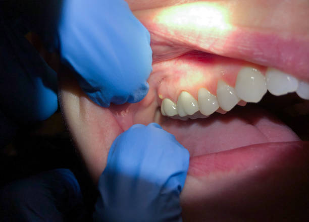 Best Emergency Dentist Near Me  in Lake Nacimiento, CA